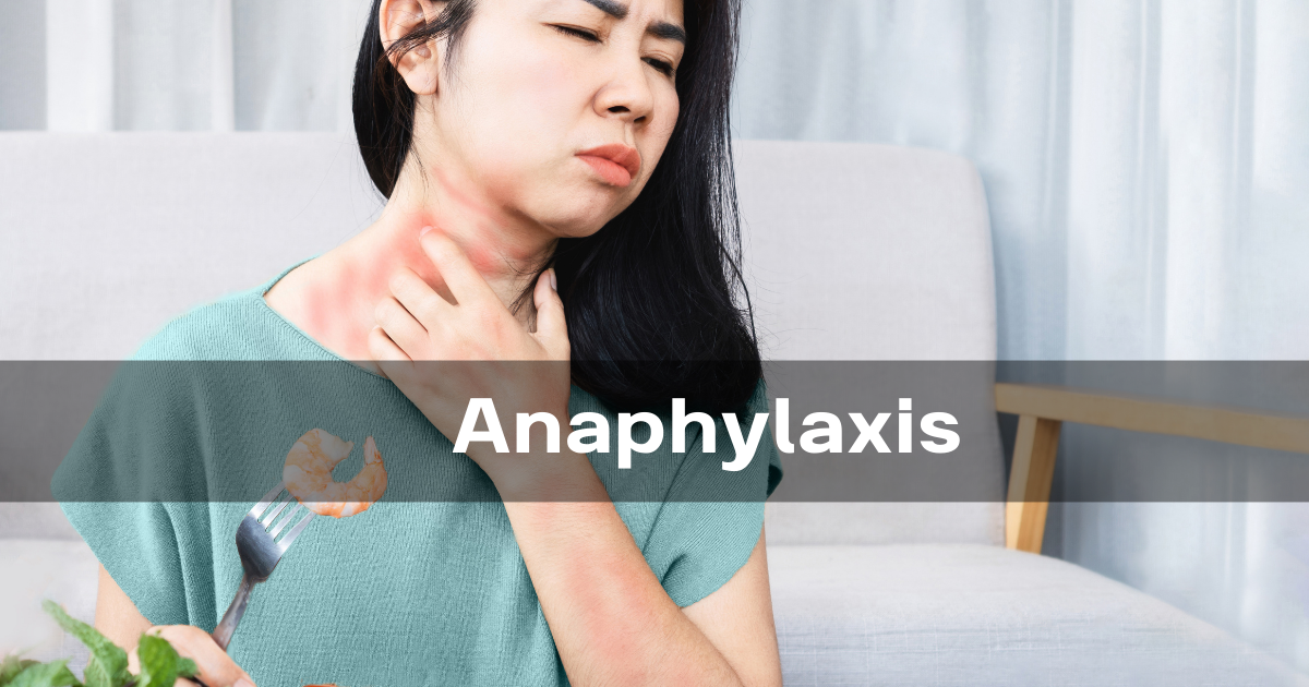 All You Need To Know About Anaphylaxis